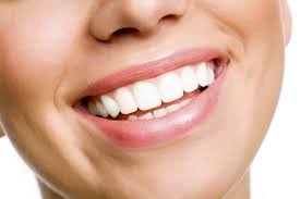 Teeth Whitening/Bleaching